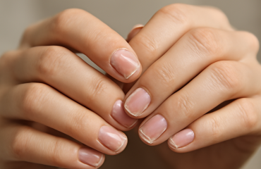 mains montrant ongles vernis fragiles